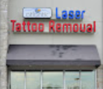 Atlantic Laser Tattoo Removal - Virginia Beach, VA