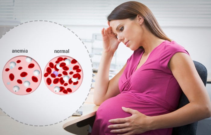 anemia symptoms in pregnancy