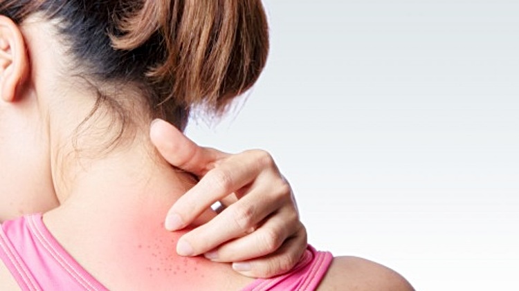 skin irritation causes back acne