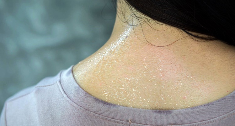 sweat causes back acne