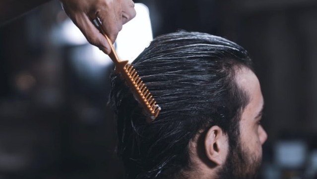 styling causes dandruff in men