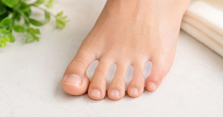 are toe spacers worth it, silicone toe spacers between the toes of a foot